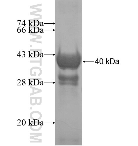 ALS2CR12 fusion protein Ag15447 SDS-PAGE