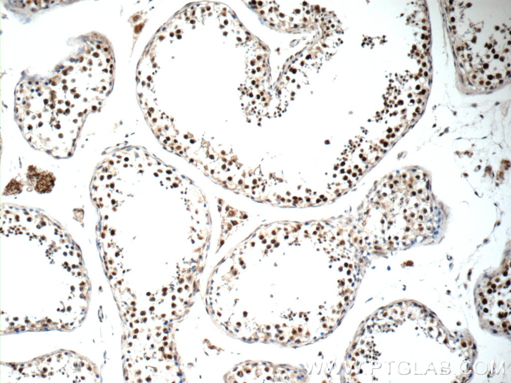Immunohistochemistry (IHC) staining of human testis tissue using ALS2CR8 Polyclonal antibody (13434-1-AP)