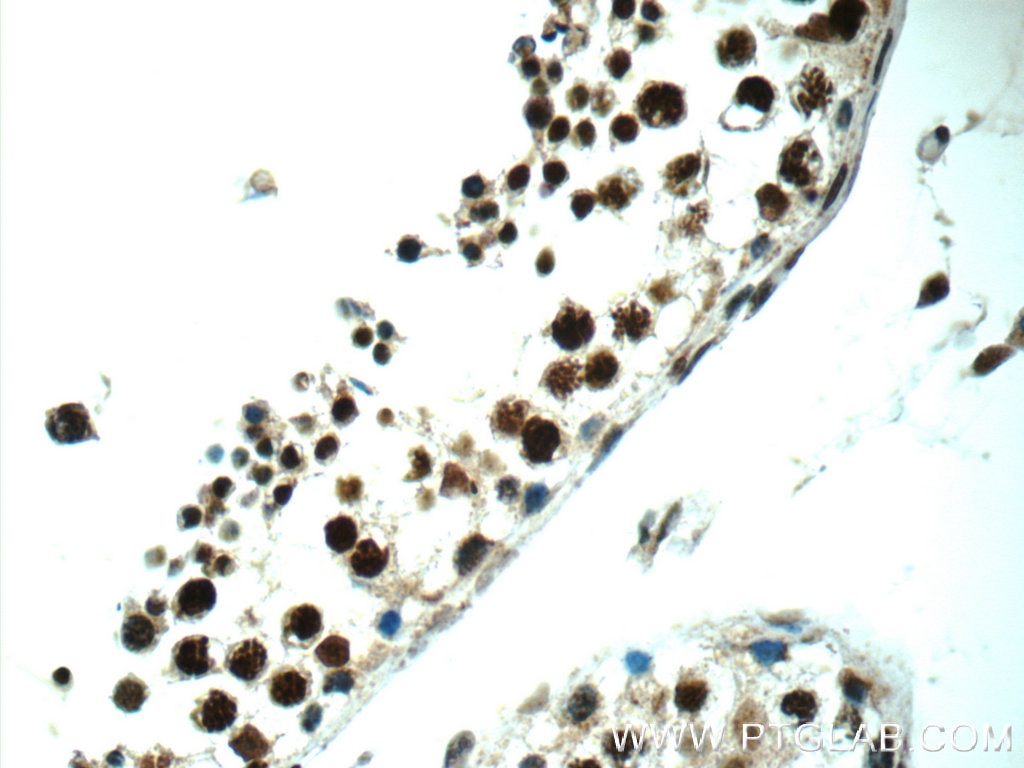 Immunohistochemistry (IHC) staining of human testis tissue using ALS2CR8 Polyclonal antibody (13434-1-AP)