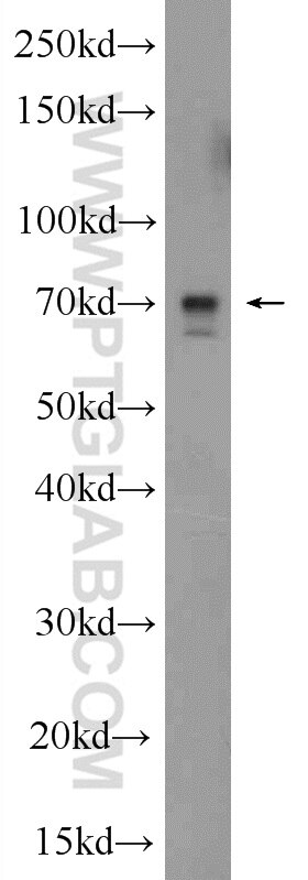 Western Blot (WB) analysis of HEK-293 cells using ALX3 Polyclonal antibody (22358-1-AP)