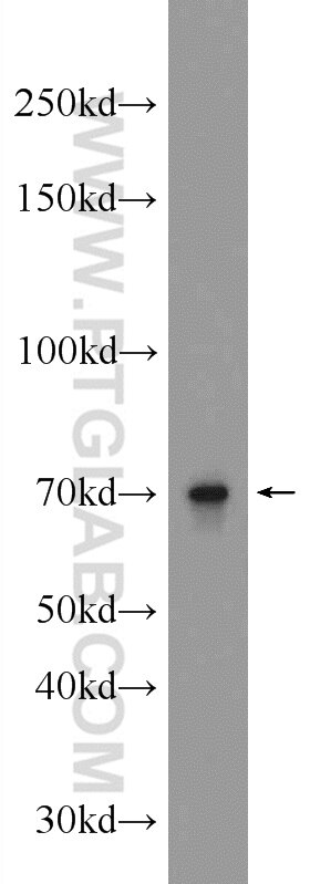 Western Blot (WB) analysis of mouse testis tissue using ALX3 Polyclonal antibody (22358-1-AP)