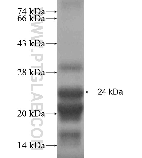 ALX3 fusion protein Ag19204 SDS-PAGE