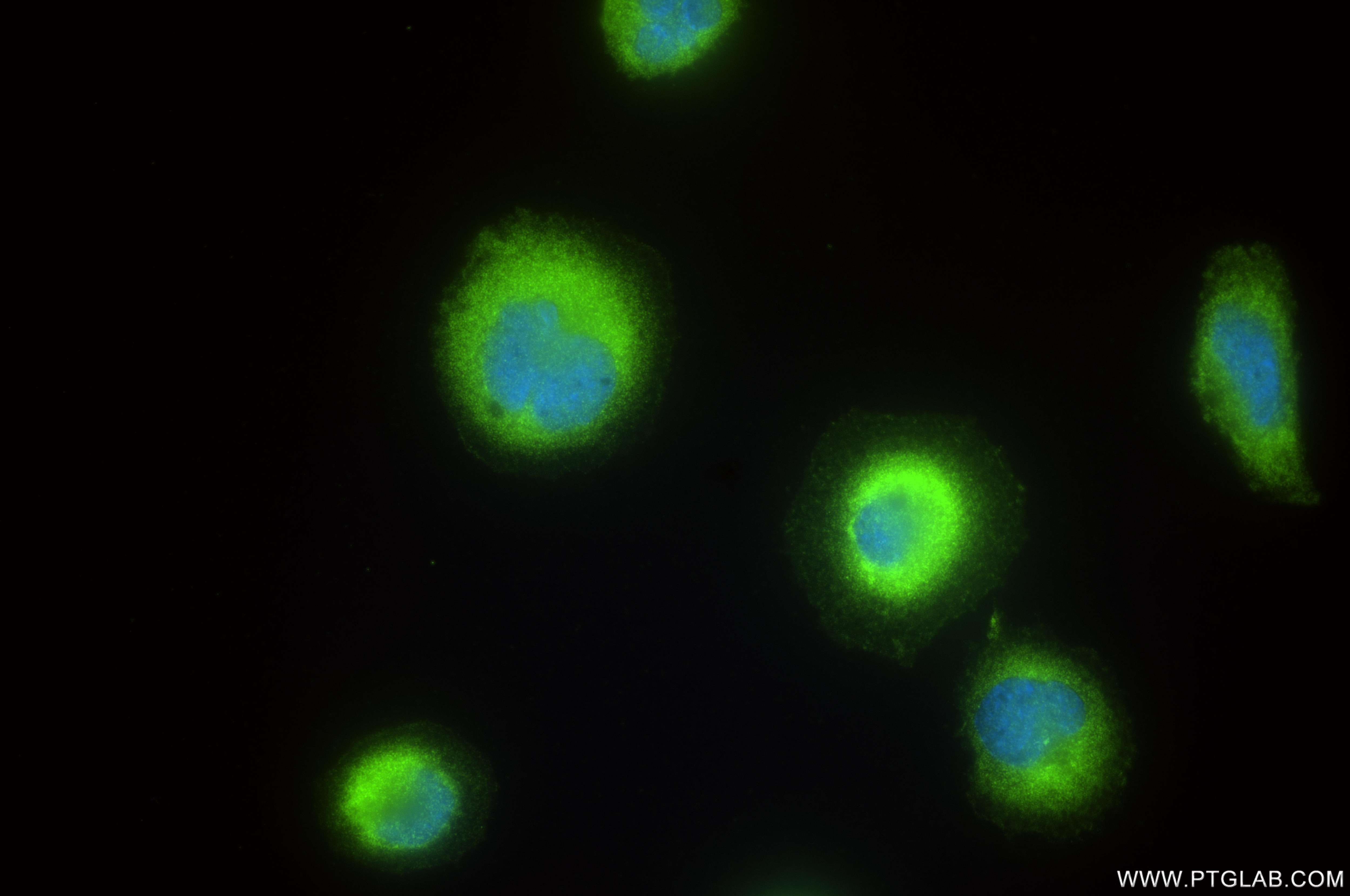 IF Staining of DU 145 using 84891-8-RR (same clone as 84891-8-PBS) Immunofluorescence (IF) / fluorescent staining of DU 145 cells using AMACR/p504S Recombinant monoclonal antibody (84891-8-RR)