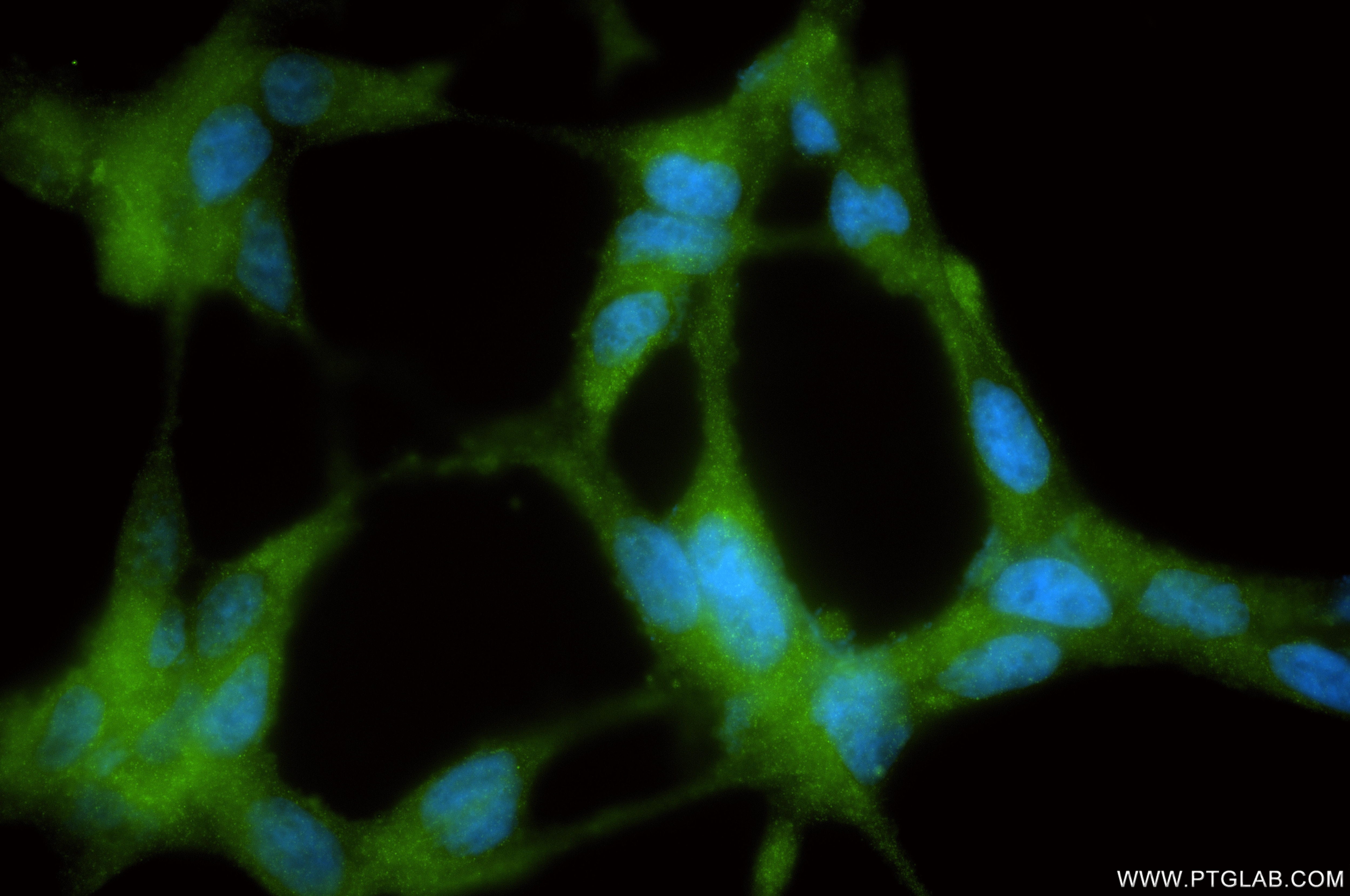 IF Staining of LNCaP using 84891-9-RR (same clone as 84891-9-PBS) Immunofluorescence (IF) / fluorescent staining of LNCaP cells using AMACR/p504S Recombinant monoclonal antibody (84891-9-RR)