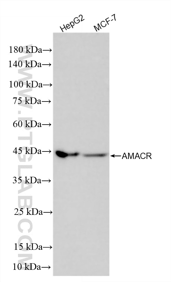 WB analysis using 84891-9-RR (same clone as 84891-9-PBS) Western Blot (WB) analysis of various lysates using AMACR/p504S Recombinant monoclonal antibody (84891-9-RR)