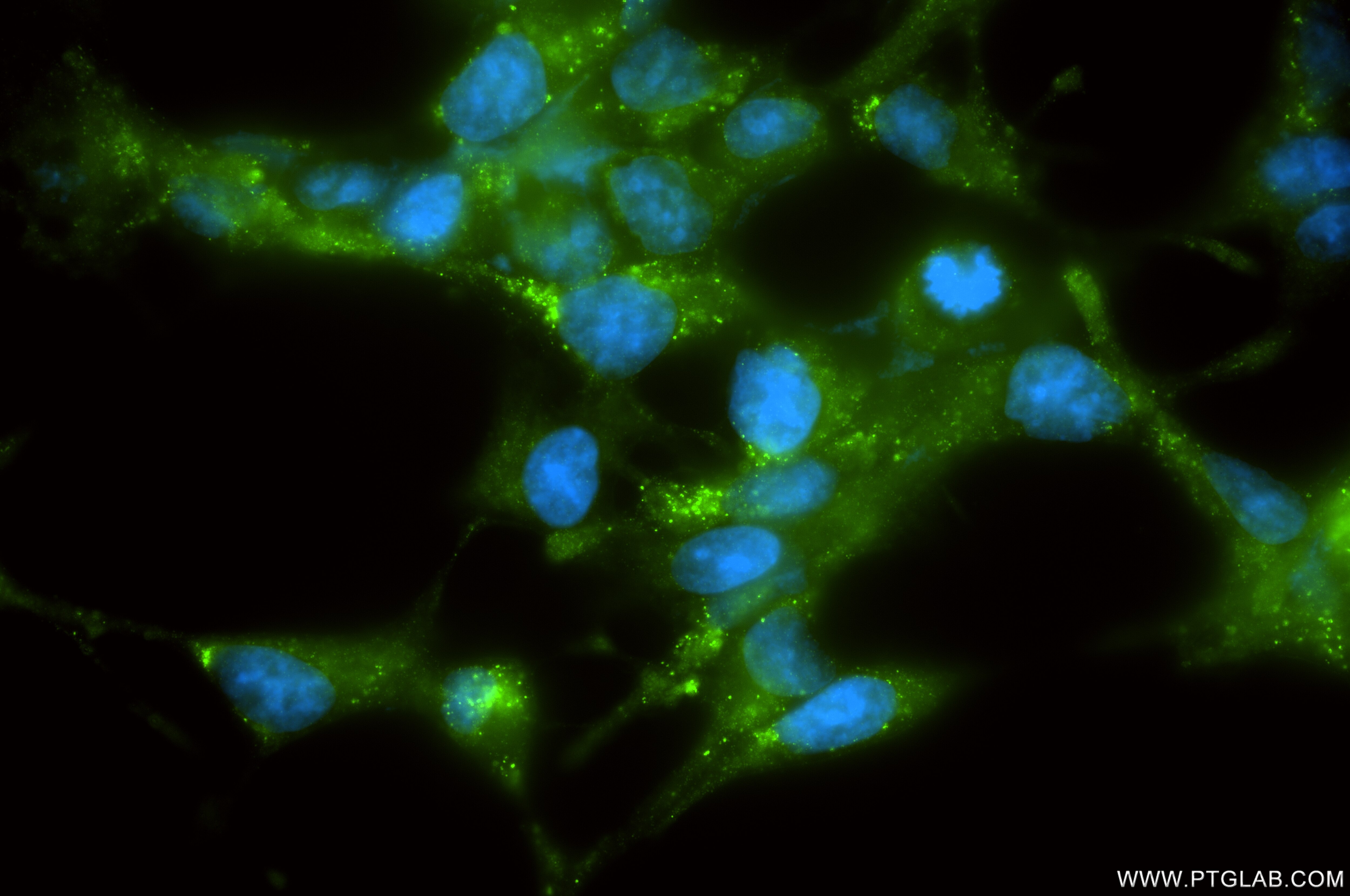 Immunofluorescence (IF) / fluorescent staining of LNCaP cells using AMACR/p504S Recombinant monoclonal antibody (84891-2-RR)