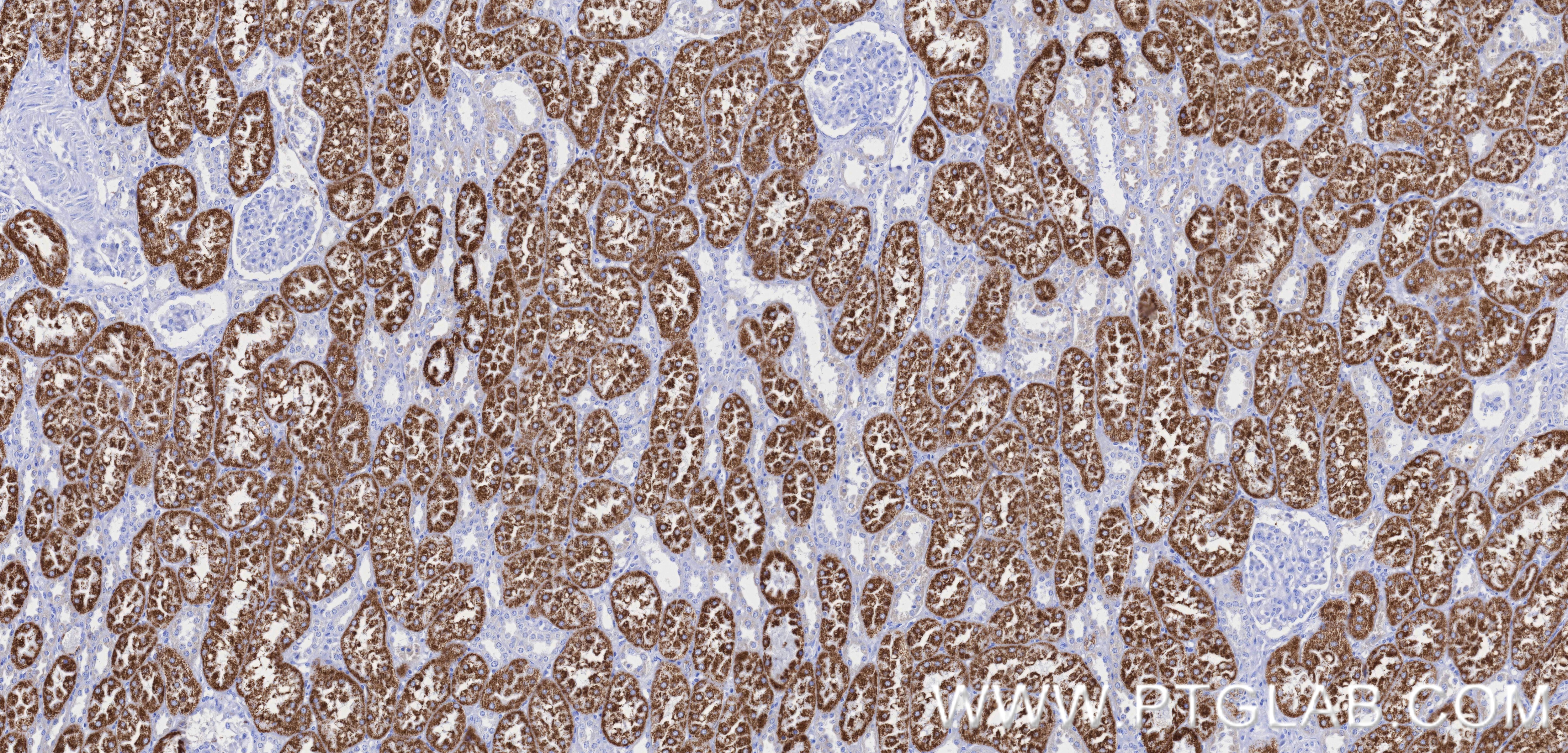 Immunohistochemistry (IHC) staining of human kidney tissue using AMACR/p504S Recombinant monoclonal antibody (84891-2-RR)