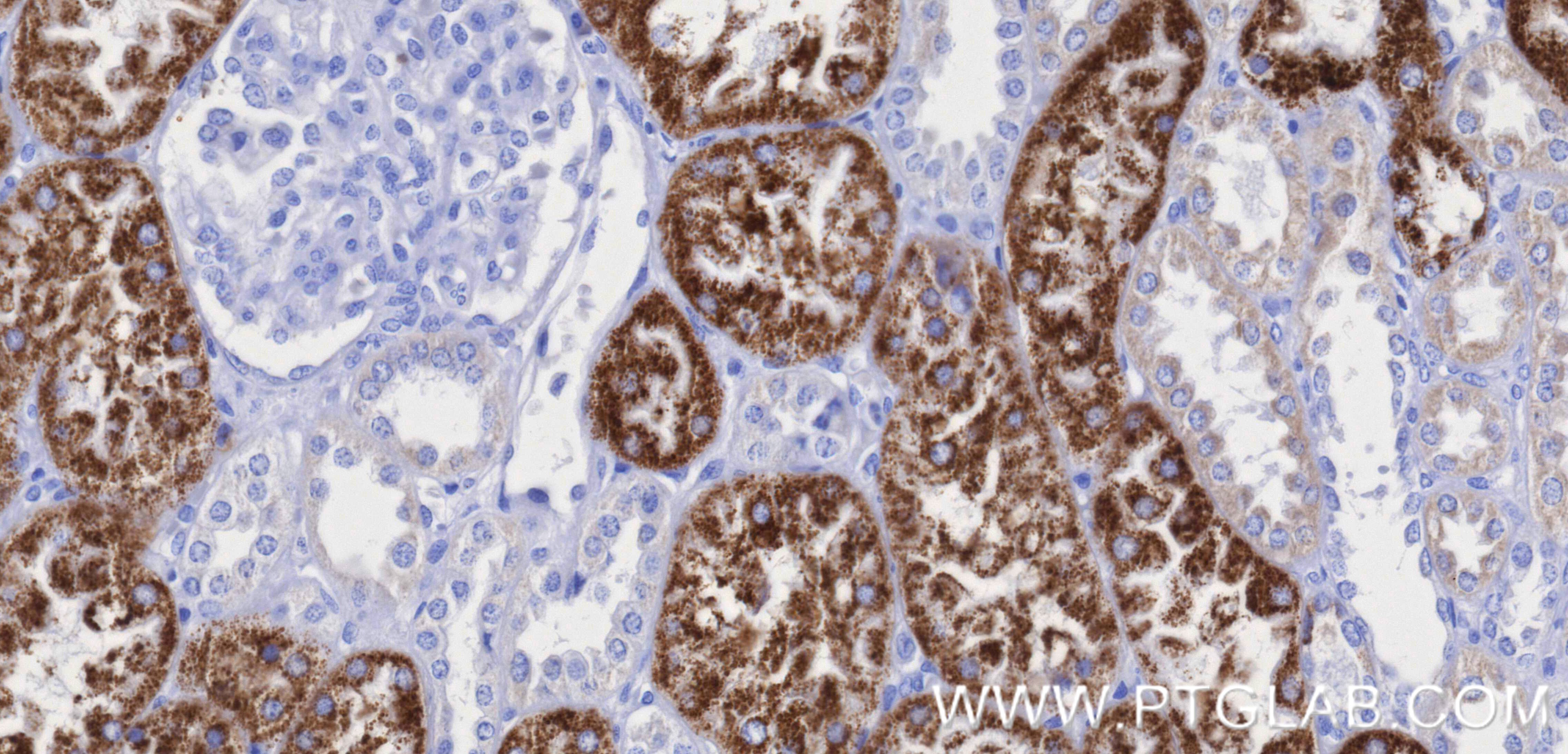 Immunohistochemistry (IHC) staining of human kidney tissue using AMACR/p504S Recombinant monoclonal antibody (84891-2-RR)