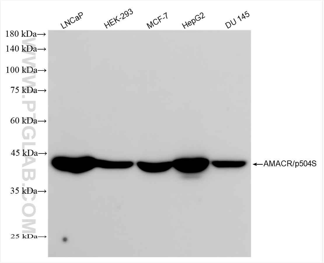 Western Blot (WB) analysis of various lysates using AMACR/p504S Recombinant antibody (84891-2-RR)
