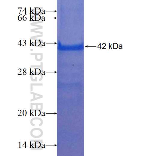 AMBP fusion protein Ag25239 SDS-PAGE