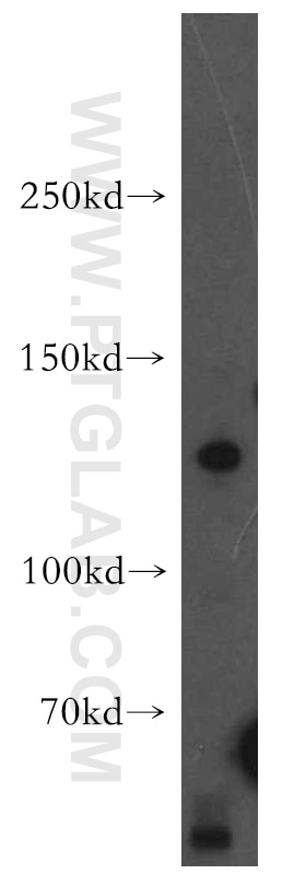 Western Blot (WB) analysis of human brain tissue using AMBRA1 Polyclonal antibody (13762-1-AP)