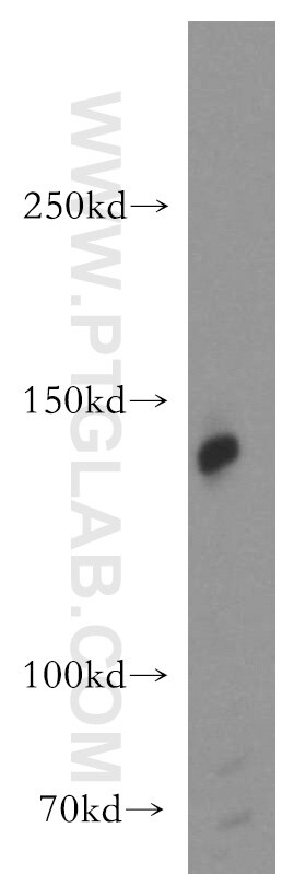 Western Blot (WB) analysis of MCF-7 cells using AMBRA1 Polyclonal antibody (13762-1-AP)