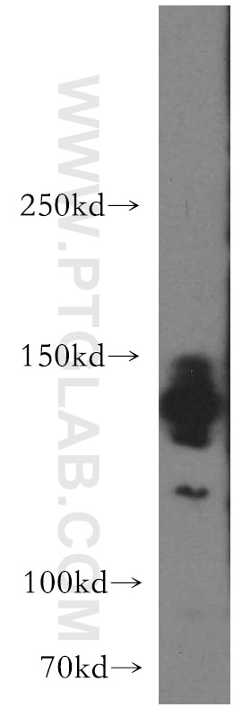 Western Blot (WB) analysis of HepG2 cells using AMBRA1 Polyclonal antibody (13762-1-AP)