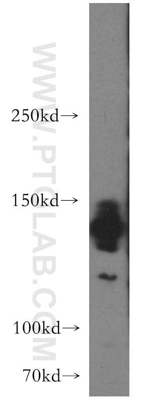 WB analysis of HepG2 using 13762-1-AP