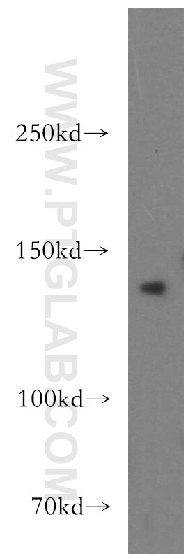 Western Blot (WB) analysis of mouse brain tissue using AMBRA1 Polyclonal antibody (13762-1-AP)