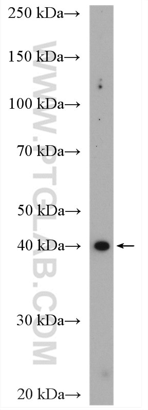 WB analysis of A431 using 11052-1-AP