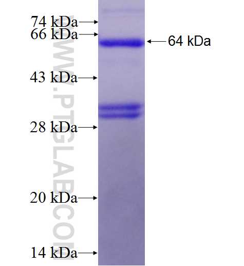 AMD1 fusion protein Ag1525 SDS-PAGE