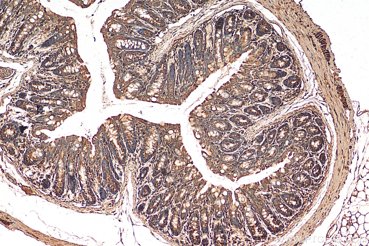 Immunohistochemistry (IHC) staining of mouse colon tissue using AMDHD1 Polyclonal antibody (21171-1-AP)