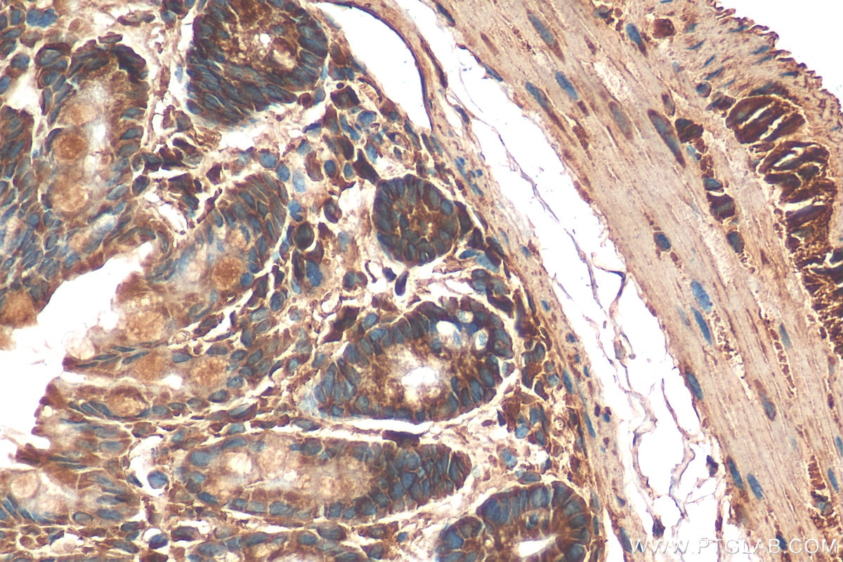 Immunohistochemistry (IHC) staining of mouse colon tissue using AMDHD1 Polyclonal antibody (21171-1-AP)