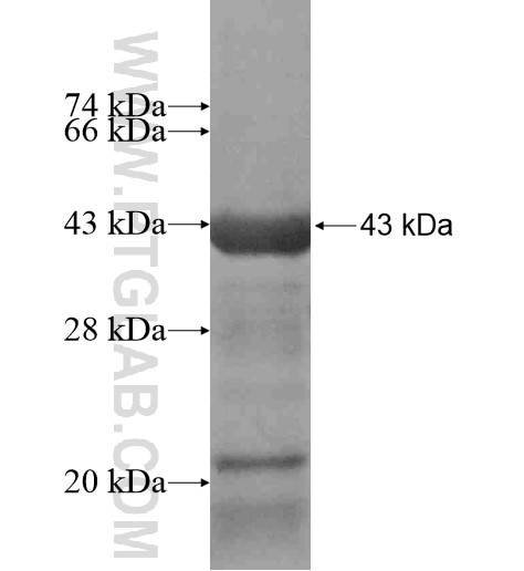 AMDHD1 fusion protein Ag15420 SDS-PAGE