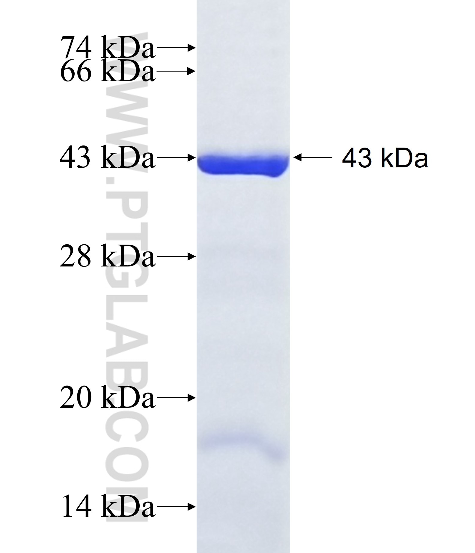 AMDHD1 fusion protein Ag15420 SDS-PAGE