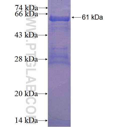 AMDHD2 fusion protein Ag22757 SDS-PAGE