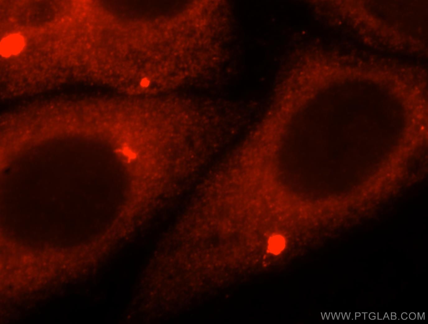 Immunofluorescence (IF) / fluorescent staining of HepG2 cells using AMFR/GP78 Polyclonal antibody (16675-1-AP)