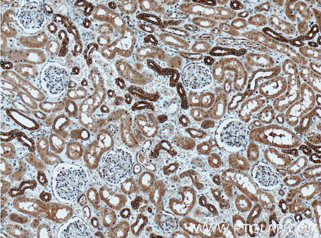 Immunohistochemistry (IHC) staining of human kidney tissue using AMFR/GP78 Polyclonal antibody (16675-1-AP)
