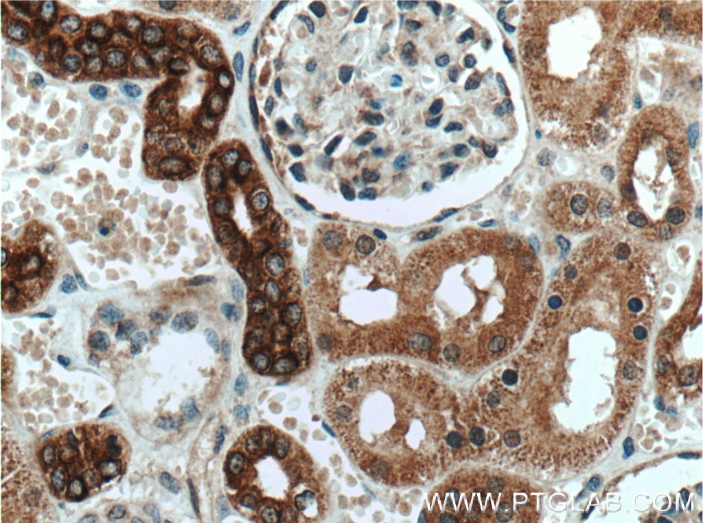 Immunohistochemistry (IHC) staining of human kidney tissue using AMFR/GP78 Polyclonal antibody (16675-1-AP)