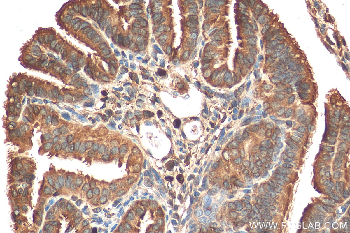 Immunohistochemistry (IHC) staining of mouse ovary tissue using AMFR/GP78 Polyclonal antibody (16675-1-AP)