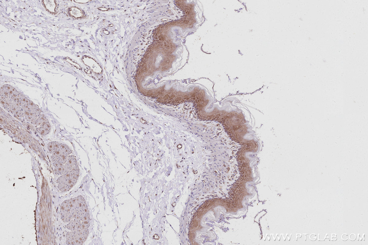 Immunohistochemistry (IHC) staining of rat stomach tissue using AMFR/GP78 Polyclonal antibody (16675-1-AP)