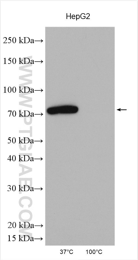 Western Blot (WB) analysis of various lysates using AMFR/GP78 Polyclonal antibody (16675-1-AP)