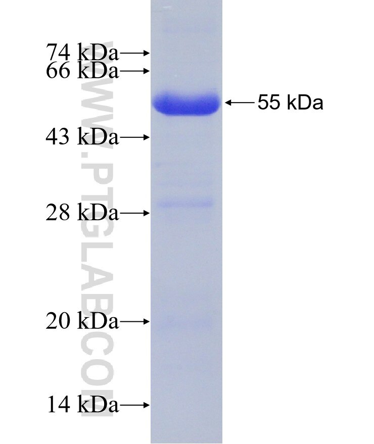 AMFR fusion protein Ag10308 SDS-PAGE