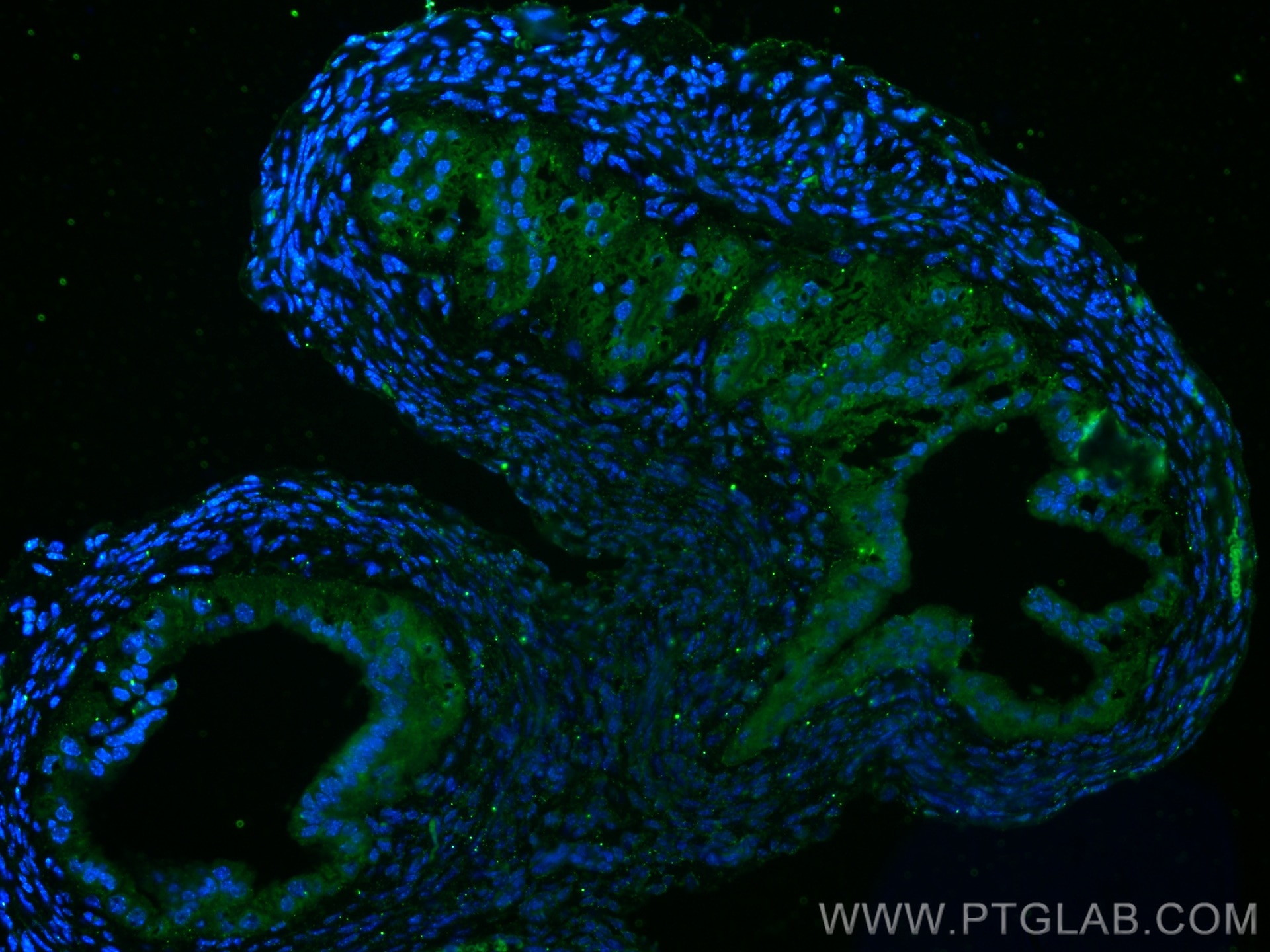 Immunofluorescence (IF) / fluorescent staining of mouse ovary tissue using AMH Polyclonal antibody (14461-1-AP)