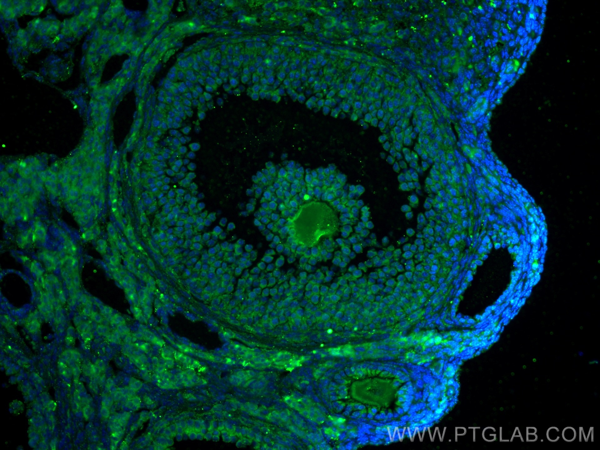Immunofluorescence (IF) / fluorescent staining of mouse ovary tissue using AMH Polyclonal antibody (14461-1-AP)