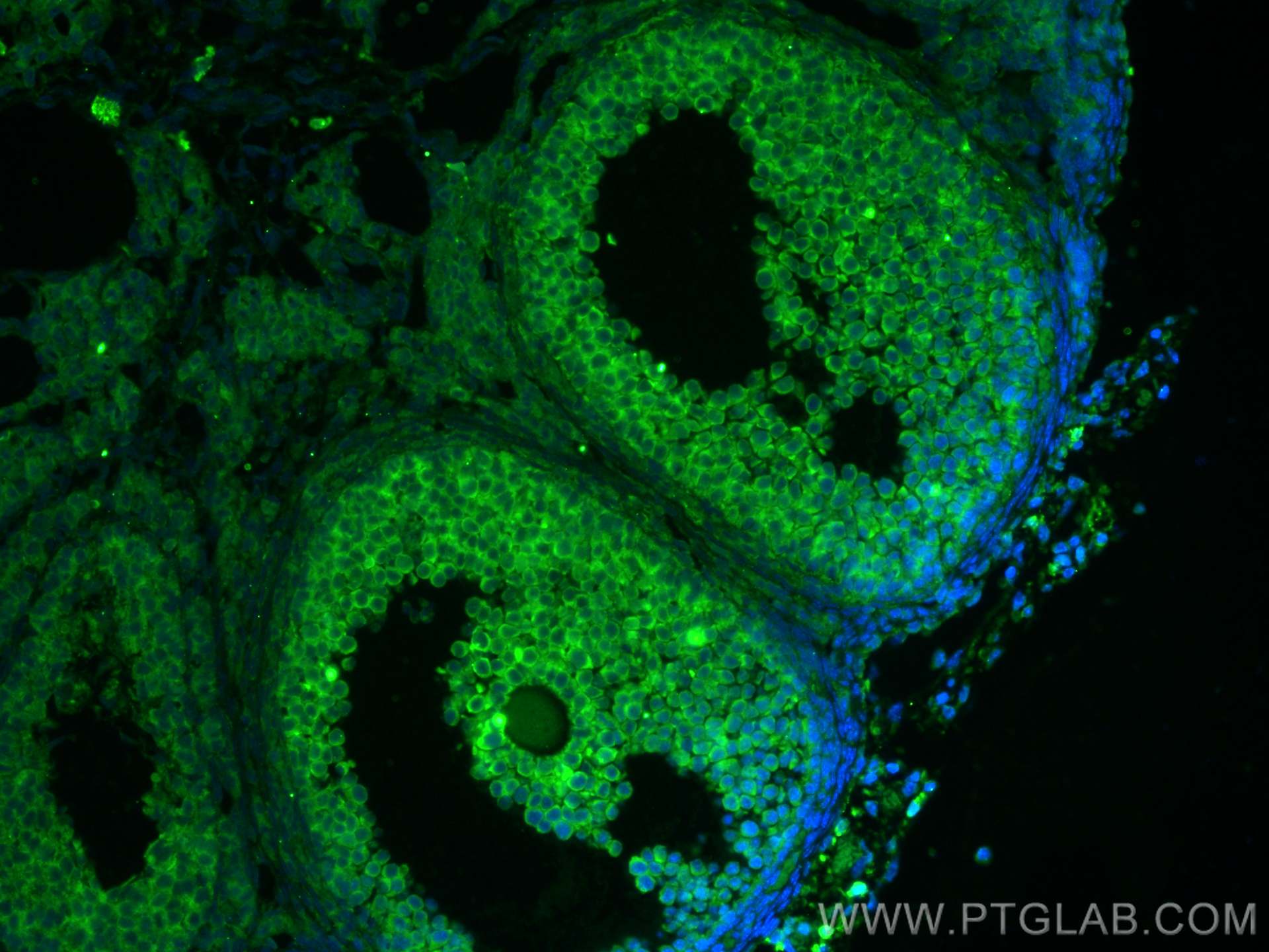 Immunofluorescence (IF) / fluorescent staining of mouse ovary tissue using AMH Polyclonal antibody (14461-1-AP)