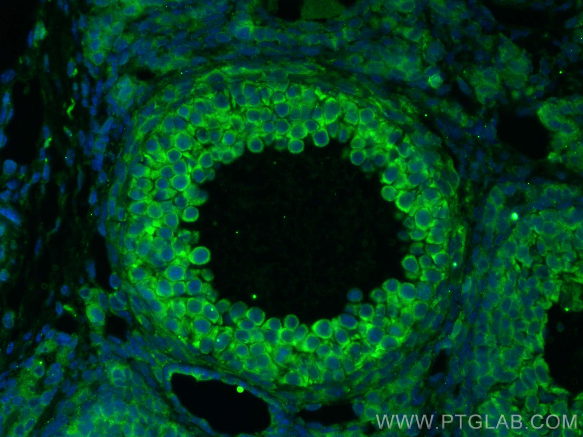 Immunofluorescence (IF) / fluorescent staining of mouse ovary tissue using AMH Polyclonal antibody (14461-1-AP)