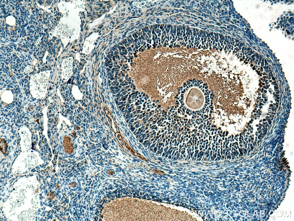 Immunohistochemistry (IHC) staining of rat ovary tissue using AMH Polyclonal antibody (14461-1-AP)