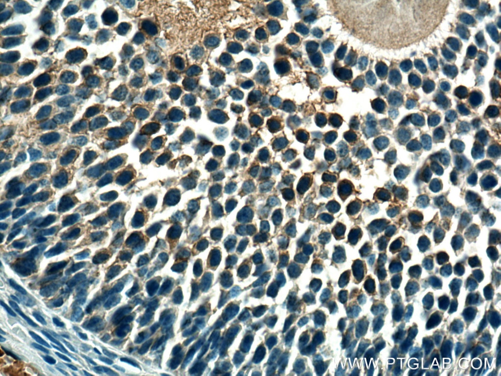 Immunohistochemistry (IHC) staining of rat ovary tissue using AMH Polyclonal antibody (14461-1-AP)