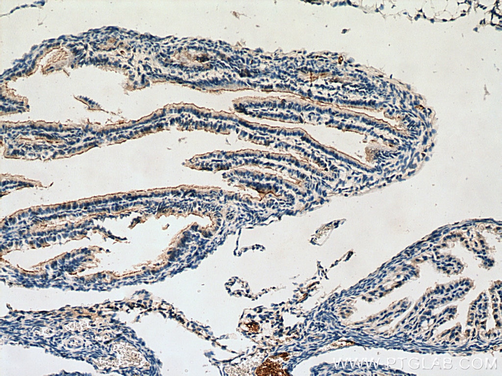 Immunohistochemistry (IHC) staining of mouse ovary tissue using AMH Polyclonal antibody (14461-1-AP)