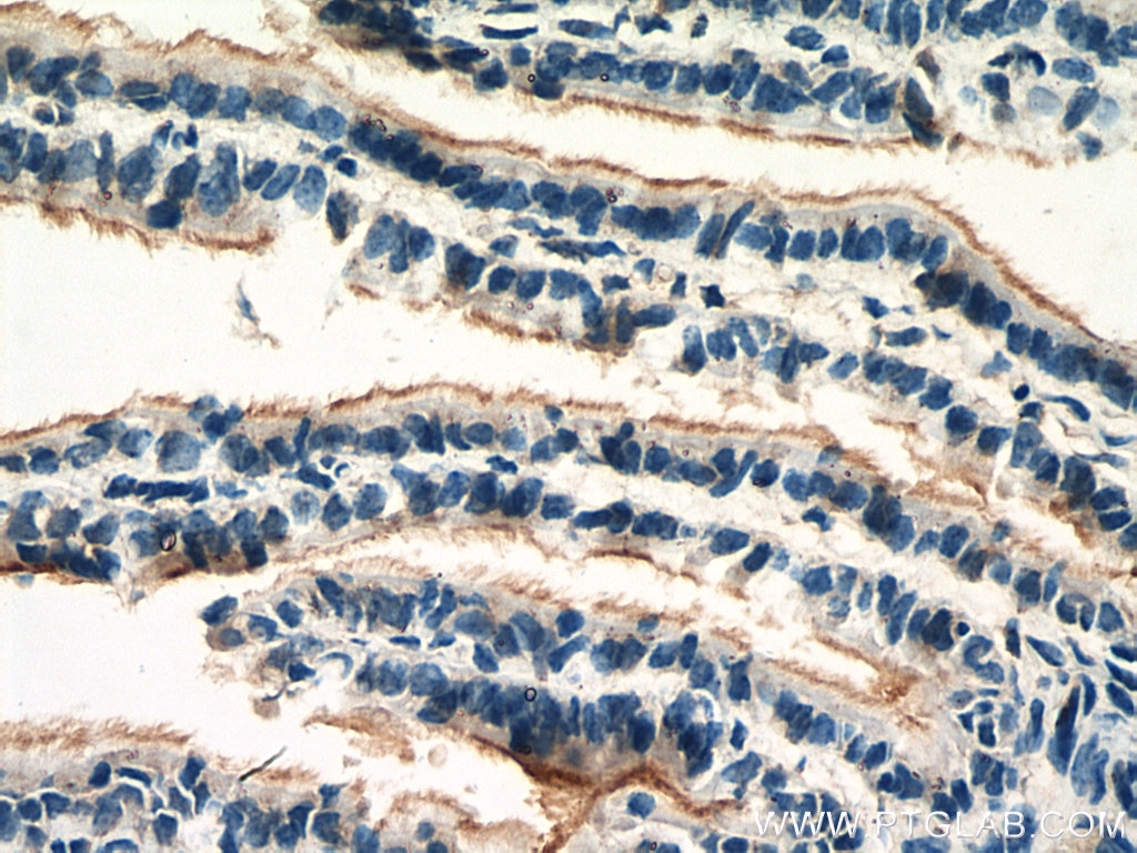 IHC staining of mouse ovary using 14461-1-AP