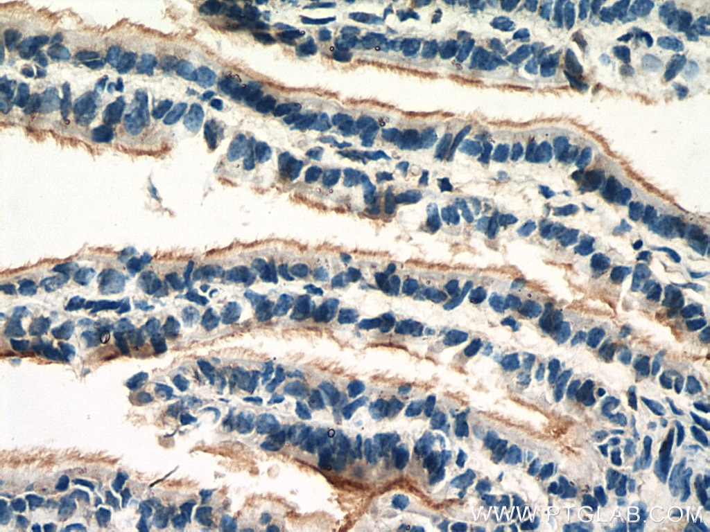 Immunohistochemistry (IHC) staining of mouse ovary tissue using AMH Polyclonal antibody (14461-1-AP)