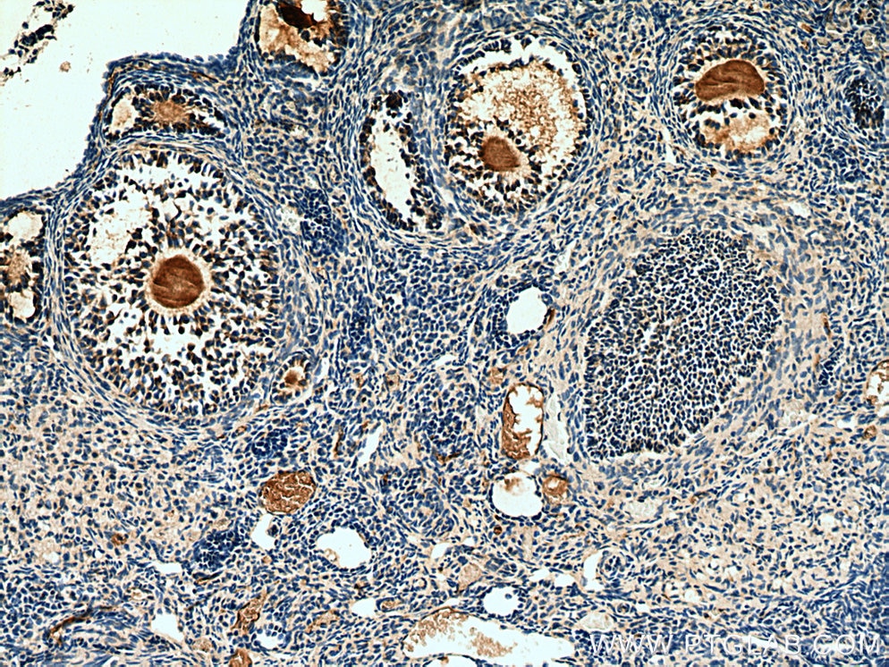 Immunohistochemistry (IHC) staining of mouse ovary tissue using AMH Polyclonal antibody (14461-1-AP)