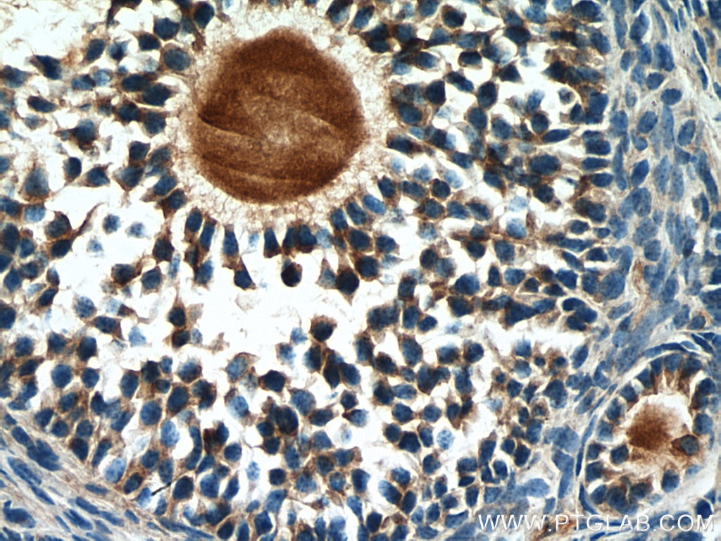 Immunohistochemistry (IHC) staining of mouse ovary tissue using AMH Polyclonal antibody (14461-1-AP)