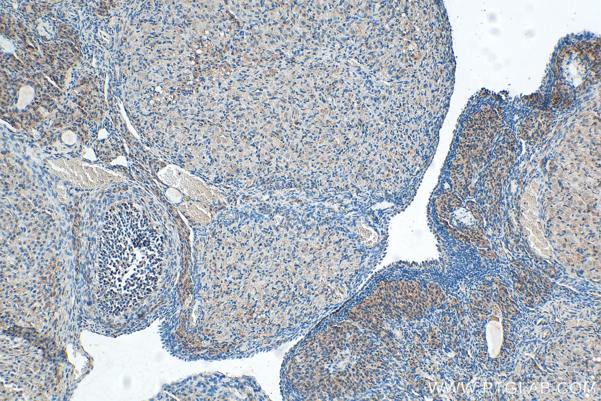 Immunohistochemistry (IHC) staining of rat ovary tissue using AMH Polyclonal antibody (14461-1-AP)