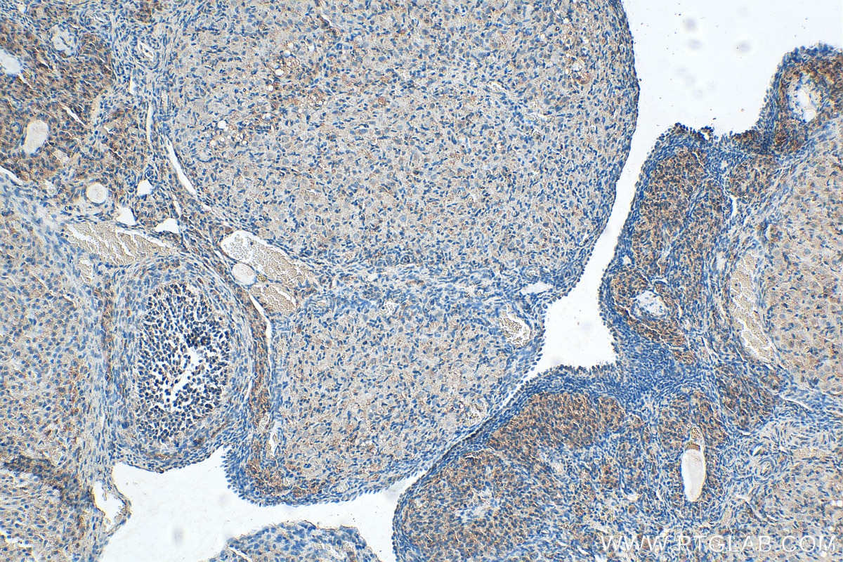 IHC staining of rat ovary using 14461-1-AP