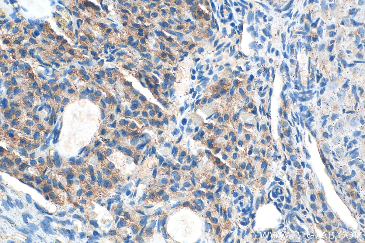 Immunohistochemistry (IHC) staining of rat ovary tissue using AMH Polyclonal antibody (14461-1-AP)