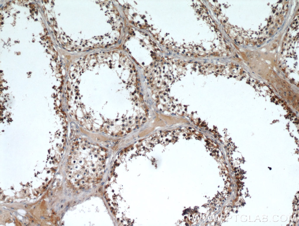 Immunohistochemistry (IHC) staining of human testis tissue using AMH Polyclonal antibody (14461-1-AP)