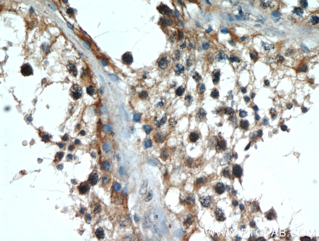 Immunohistochemistry (IHC) staining of human testis tissue using AMH Polyclonal antibody (14461-1-AP)