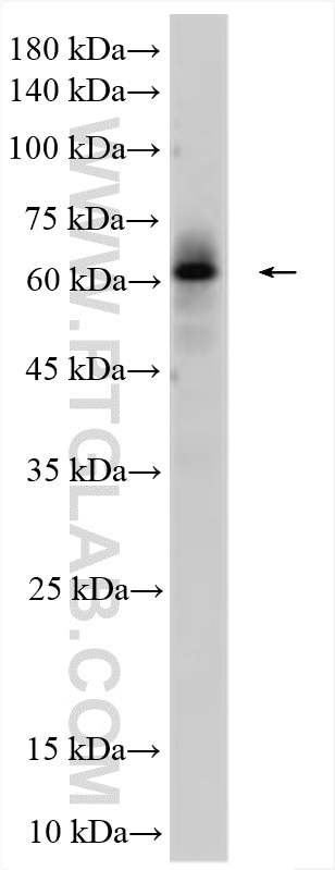 Western Blot (WB) analysis of human testis tissue using AMH Polyclonal antibody (14461-1-AP)